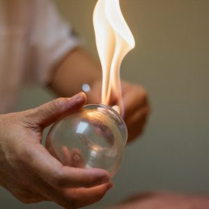 An open flame is used to extinguish the oxygen inside of special glass cups which creates a temporary suction. The cup is then quickly placed on the appropriate area of the person receiving cupping treatment, usually along the back or neck, where the suction holds the cup in place. Cupping is an effective form of pain relief treatment used commonly in Traditional Chinese Medicine (TCM) along with acupuncture.